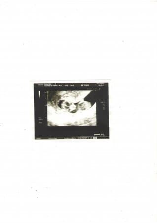 Ezimova Aytac Moskvada ushagin basinda problem oldugunu deyibler,heqiqeten var.mualice edib sagaldacam